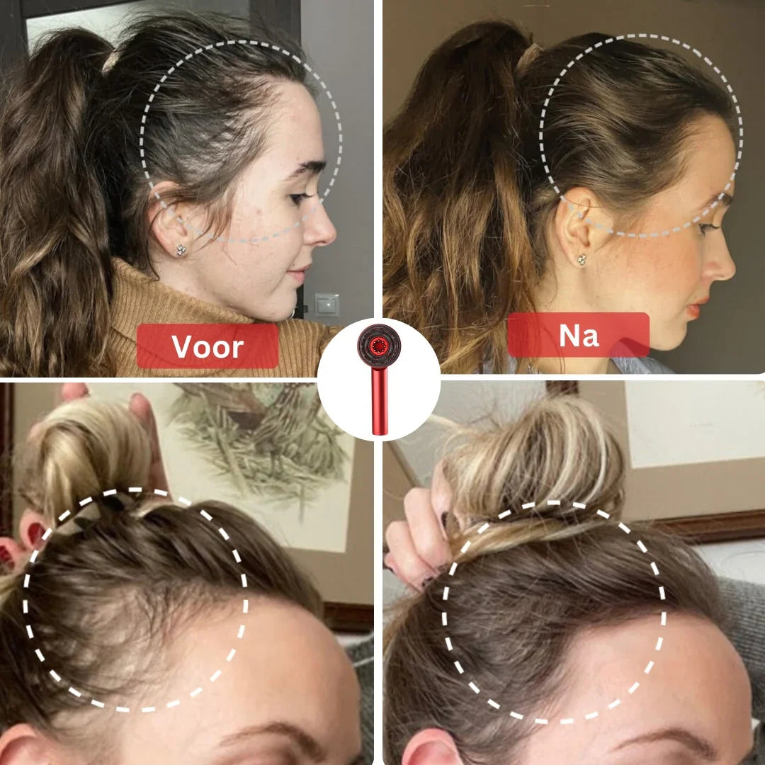 Goodielicious™ - Massageborstel: Laat je haar groeien!
